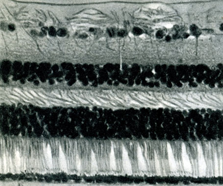 Фотография слоев сетчатки (в разрезе), сделанная с помощью оптического микроскопа. Свет на сетчатку падает сверху и, перед тем как попасть в палочки и колбочки - вытянутые веретенообразные тела, проходит через несколько слоев специальных нервных клеток